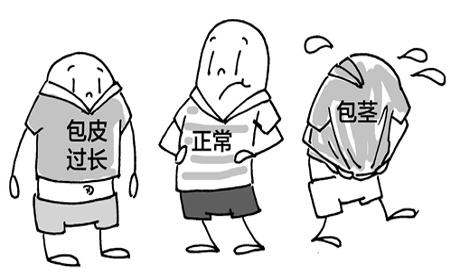 包皮過長包莖圖片是什么樣的?